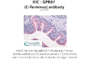 Image no. 1 for anti-G Protein-Coupled Receptor 87 (GPR87) (C-Term) antibody (ABIN1735186) (GPR87 Antikörper  (C-Term))
