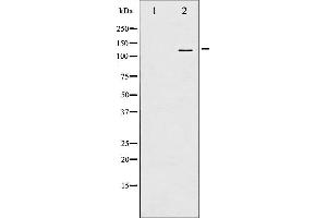 Western Blotting (WB) image for anti-PTK2 Protein tyrosine Kinase 2 (PTK2) (pTyr397) antibody (ABIN6256730)