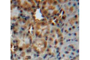 Immunohistochemistry (IHC) image for anti-Cytochrome P450, Family 24, Subfamily A, Polypeptide 1 (CYP24A1) (AA 37-250) antibody (ABIN1862404)