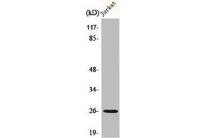 Western Blot analysis of Jurkat cells using C1q-B Polyclonal Antibody (C1QB Antikörper  (C-Term))