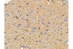 ABIN6258262 and ABIN6273481 at 1/100 staining Rat brain tissue by IHC-P. (MAP3K12 Antikörper  (N-Term))