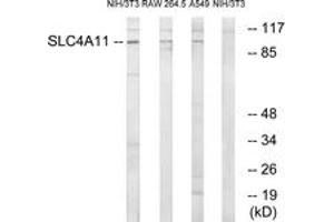 Western Blotting (WB) image for anti-Solute Carrier Family 4, Sodium Borate Transporter, Member 11 (SLC4A11) (AA 291-340) antibody (ABIN1535375)