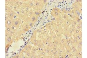 Immunohistochemistry of paraffin-embedded human liver tissue using ABIN7166376 at dilution of 1:100 (ZNF738 Antikörper  (AA 1-137))