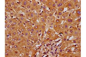 IHC image of ABIN7168014 diluted at 1:200 and staining in paraffin-embedded human liver tissue performed on a Leica BondTM system. (RND1 Antikörper  (AA 1-106))