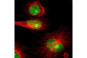Immunofluorescence of U-251 MG cell line with IFI16 polyclonal antibody  shows positivity in nucleus and nucleoli. (IFI16 Antikörper)