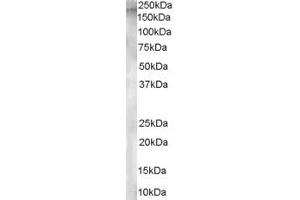 ABIN185416 staining (1µg/ml) of Human Testis lysate (RIPA buffer, 30µg total protein per lane). (ENPEP Antikörper  (Internal Region))