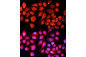 Immunofluorescence analysis of HeLa cells using MRPS28 Polyclonal Antibody (ABIN6133074, ABIN6144041, ABIN6144042 and ABIN6220731) at dilution of 1:100 (40x lens). (MRPS28 Antikörper  (AA 1-187))