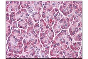 Human Pancreas: Formalin-Fixed, Paraffin-Embedded (FFPE) (GPC4 Antikörper  (C-Term))