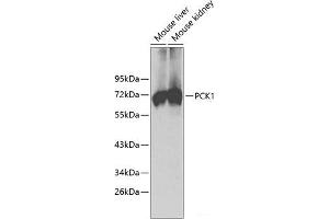 Western blot analysis of extracts of various cell lines using PCK1 Polyclonal Antibody. (PCK1 Antikörper)
