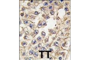Formalin-fixed and paraffin-embedded human testis tissue reacted with EPHA10 antibody (Center), which was peroxidase-conjugated to the secondary antibody, followed by DAB staining. (EPH Receptor A10 Antikörper  (AA 440-469))
