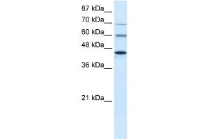 WB Suggested Anti-PRMT3 Antibody Titration:  0. (PRMT3 Antikörper  (Middle Region))