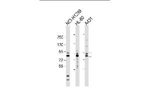 All lanes : Anti-P9 Antibody  at 1:2000 dilution Lane 1: NCI- whole cell lysate Lane 2: HL-60 whole cell lysate Lane 3: A431 whole cell lysate Lysates/proteins at 20 μg per lane. (MMP 9 Antikörper  (C-Term))