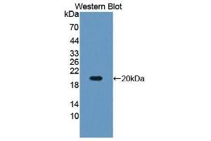 Western Blotting (WB) image for anti-Insulin-Like Growth Factor Binding Protein 3 (IGFBP3) (AA 152-292) antibody (ABIN1172098) (IGFBP3 Antikörper  (AA 152-292))