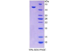 SDS-PAGE analysis of Human PC Protein. (PC Protein)