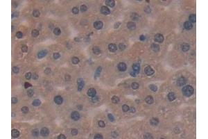 Immunohistochemistry (IHC) image for anti-Matrix Metallopeptidase 7 (Matrilysin, Uterine) (MMP7) (AA 1-264) antibody (ABIN7431017)