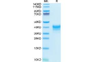 FOLR1 Protein (AA 25-233) (His tag)