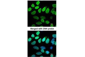ICC/IF Image Immunofluorescence analysis of paraformaldehyde-fixed HeLa, using VCP(p97), antibody at 1:200 dilution.