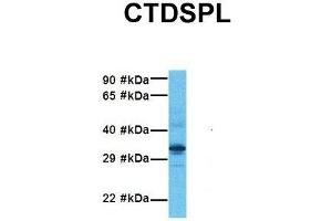 Host:  Rabbit  Target Name:  CTDSPL  Sample Tissue:  Human Fetal Liver  Antibody Dilution:  1. (CTDSPL Antikörper  (N-Term))