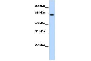 WB Suggested Anti-RNF6 Antibody Titration:  1. (RNF6 Antikörper  (N-Term))