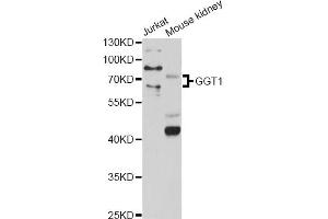 Western blot analysis of extracts of various cell lines, using GGT1 antibody (ABIN1872809) at 1:1000 dilution.