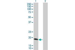 Western Blot analysis of IL17C expression in transfected 293T cell line by IL17C MaxPab polyclonal antibody. (IL17C Antikörper  (AA 1-197))
