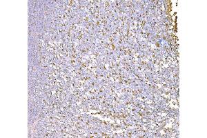 IHC analysis of SND1 using anti-SND1 antibody (ABIN7600525). (SND1 Antikörper  (AA 20-204))