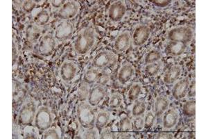 Image no. 1 for anti-SUMO1/sentrin Specific Protease 6 (SENP6) (AA 1-111) antibody (ABIN599203) (SENP6 Antikörper  (AA 1-111))