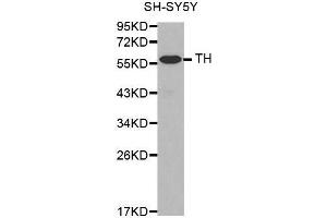 Western Blotting (WB) image for anti-Tyrosine Hydroxylase (TH) antibody (ABIN6213590) (Tyrosine Hydroxylase Antikörper)