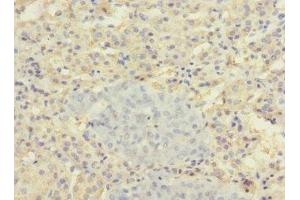 Immunohistochemistry of paraffin-embedded human adrenal gland tissue using ABIN7170165 at dilution of 1:100 (SLC22A8 Antikörper  (AA 473-542))