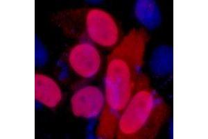 Immunofluorescent analysis of FLAG-tag staining in 293T cells transfected with a Flag-tag protein. (DYKDDDDK Tag Antikörper)