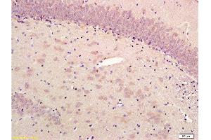 Formalin-fixed and paraffin embedded rat hippocampus labeled with Rabbit Anti-alpha-Synuclein (NT) Polyclonal Antibody, Unconjugated  1:300 followed by conjugation to the secondary antibody and DAB staining (SNCA Antikörper  (AA 51-90))