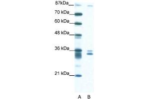 WB Suggested Anti-PKNOX2 Antibody Titration: 1. (PKNOX2 Antikörper  (N-Term))