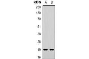 Western blot analysis of STMN1 (pS38) expression in Hela (A), Jurkat (B) whole cell lysates. (Stathmin 1 Antikörper  (N-Term, pSer38))