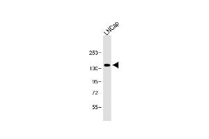 Anti-POTEE Antibody (Center) at 1:1000 dilution + LNCap whole cell lysate Lysates/proteins at 20 μg per lane. (POTEE Antikörper  (AA 380-409))