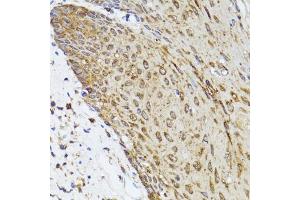 Immunohistochemistry of paraffin-embedded human esophagus using TOLLIP antibody. (TOLLIP Antikörper)