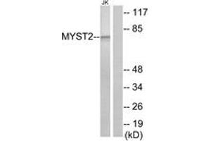 Western Blotting (WB) image for anti-MYST Histone Acetyltransferase 2 (MYST2) (AA 131-180) antibody (ABIN2889358) (MYST2 Antikörper  (AA 131-180))