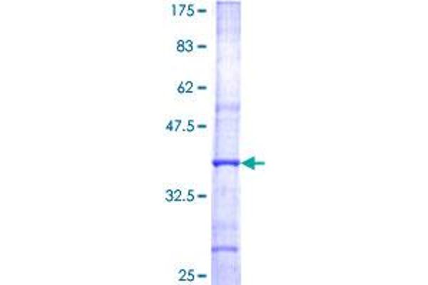 GCNT2 Protein (AA 303-402) (GST tag)