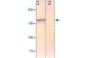 The cell lysate derived from NIH/3T3 was immunoprobed by LRP6 polyclonal antibody  at 1 : 500. (LRP6 Antikörper)