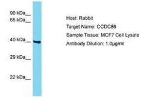 Image no. 1 for anti-Coiled-Coil Domain Containing 86 (CCDC86) (AA 101-150) antibody (ABIN6750553)