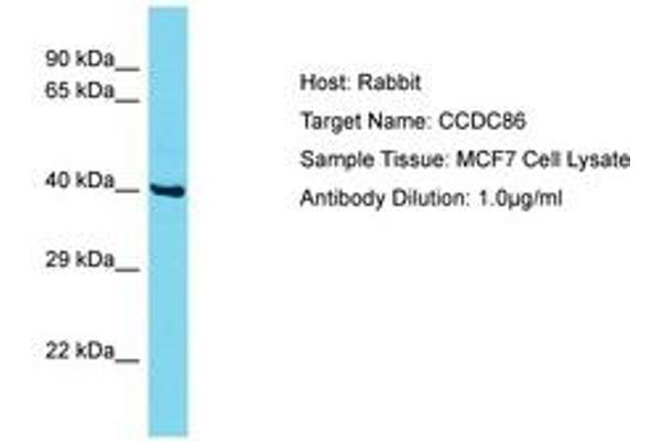 CCDC86 anticorps  (AA 101-150)