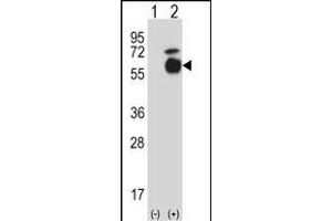 Western blot analysis of Acvr1 (arrow) using rabbit polyclonal Mouse Acvr1 Antibody (Center) (ABIN657718 and ABIN2846706). (ACVR1 Antikörper  (AA 137-166))