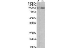 Western Blotting (WB) image for anti-Hypermethylated in Cancer 1 (HIC1) (AA 193-204) antibody (ABIN5868799) (HIC1 Antikörper  (AA 193-204))