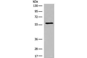 Western blot analysis of Jurkat cell lysate using M1AP Polyclonal Antibody at dilution of 1:600 (Meiosis 1 Associated Protein (M1AP) Antikörper)