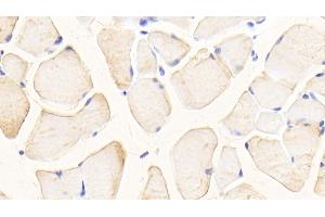 Detection of GLS in Mouse Skeletal muscle Tissue using Polyclonal Antibody to Glutaminase (GLS) (Glutaminase Antikörper  (AA 31-253))
