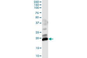 Immunoprecipitation of GUCA1C transfected lysate using anti-GUCA1C MaxPab rabbit polyclonal antibody and Protein A Magnetic Bead , and immunoblotted with GUCA1C purified MaxPab mouse polyclonal antibody (B01P) . (GUCA1C Antikörper  (AA 1-209))