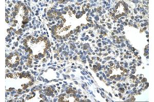Rabbit Anti-HDAC9 Antibody       Paraffin Embedded Tissue:  Human alveolar cell   Cellular Data:  Epithelial cells of renal tubule  Antibody Concentration:   4. (HDAC9 Antikörper  (C-Term))