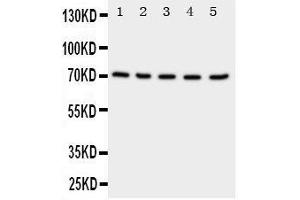 Neuregulin 1 Antikörper  (C-Term)