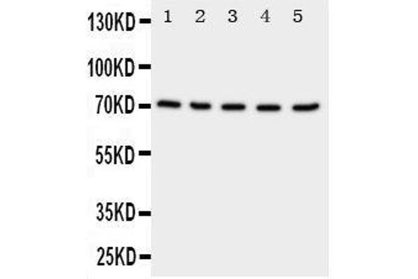 Neuregulin 1 Antikörper  (C-Term)