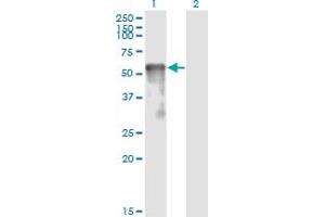 Western Blotting (WB) image for anti-Sestrin 2 (SESN2) (AA 1-481) antibody (ABIN466250) (Sestrin 2 Antikörper  (AA 1-481))