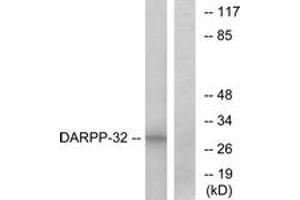 Western blot analysis of extracts from COS7 cells, treated with forskolin 40nM 30', using DARPP-32 (Ab-34) Antibody. (DARPP32 Antikörper  (AA 18-67))